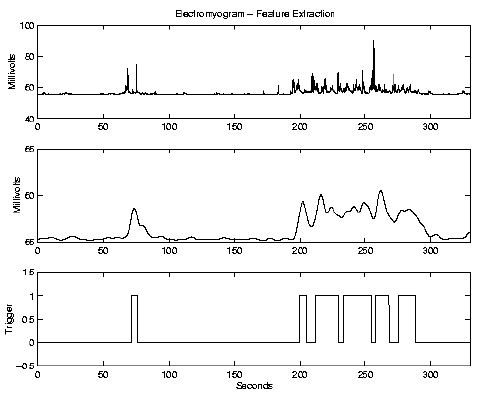 \begin{figure}\centerline{\psfig{figure=/v/projects/AC/jen-pics/volvo/emgrmbs.ps,width=85truemm}}
\end{figure}