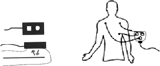 \begin{figure}\begin{center}
\begin{tabular}{cc}
\psfig{figure=/v/projects/AC/je...
.../AC/jen-pics/sensors/ekg.ps,width=45truemm}\end{tabular}\end{center}\end{figure}