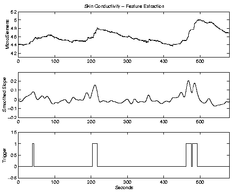 \begin{figure}\centerline{\psfig{figure=/v/projects/AC/jen-pics/volvo/gsrrmbs.ps,width=85truemm}}
\end{figure}