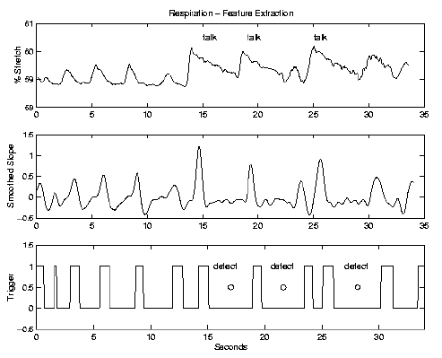 \begin{figure}\centerline{\psfig{figure=/v/projects/AC/jen-pics/volvo/resprmbs.ps,width=85truemm}}
\end{figure}