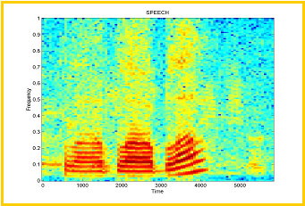 Speech Spectrogram